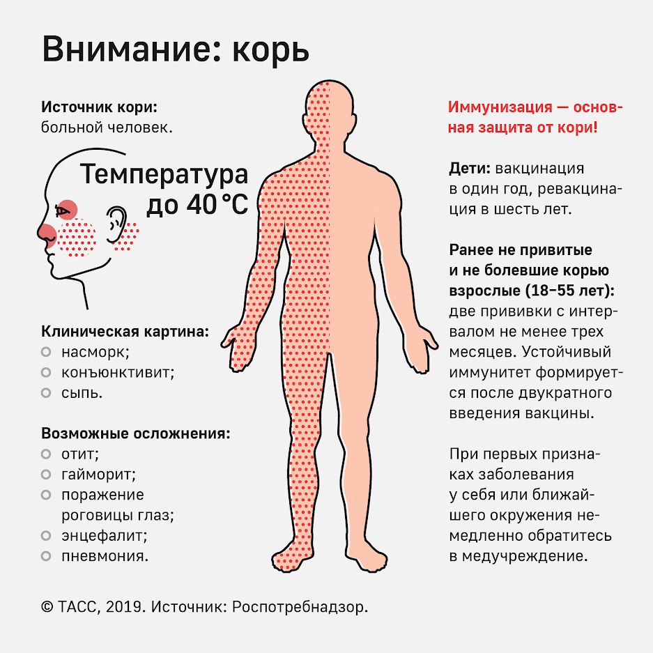 http://edu.mari.ru/mouo-yoshkarola/dou65/DocLib25/корь/внимание%20корь.JPG